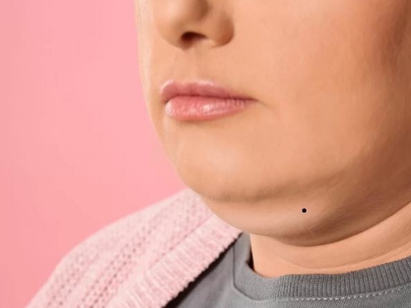 Nốt ruồi dưới nọng cằm nữ nói lên điều gì?