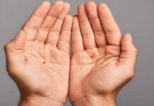 Nốt ruồi tài lộc ở nam, nữ nằm ở đâu trên mặt, cổ, tay?